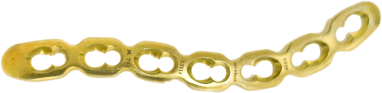 С-подібна блокуюча пластина для ключиці , права, ЕЙЧ БІ ОРТО